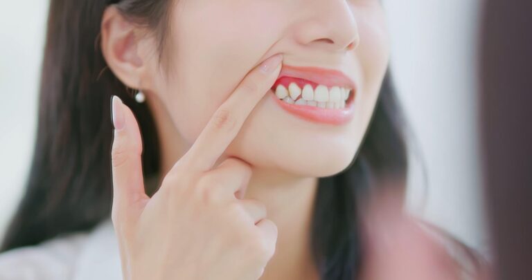 Closeup back view of asian woman looking in the mirror at inflamed and swollen gums feels ache uncomfortable - periodontal disease