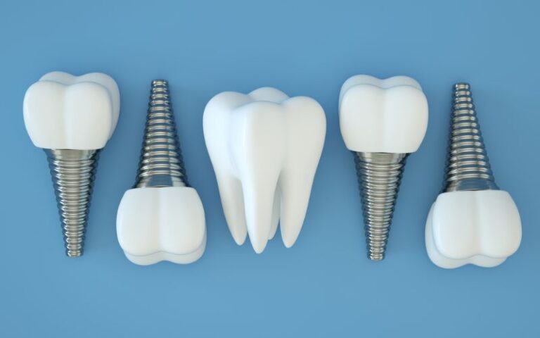Five dental implants arranged in a row on a blue background. The implants have white tooth-like crowns attached to metallic screw-like bases. The central object is a natural tooth.